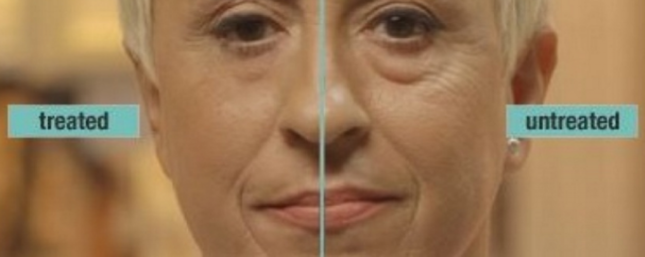 Jūs nomāc maisiņi un loki zem acīm? Esam gatavi problēmu vērst par labu!